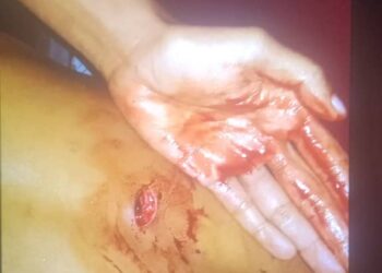 Joven ida hetan sona husi kotuk suku pontu 10 iha Baha Suku Foho Ailiku