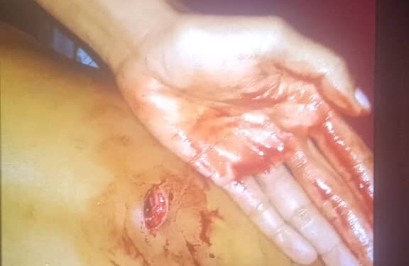 Joven ida hetan sona husi kotuk suku pontu 10 iha Baha Suku Foho Ailiku