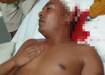 Asaltu malu iha Soro membru PNTL ida kanek