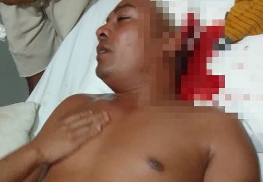 Asaltu malu iha Soro membru PNTL ida kanek