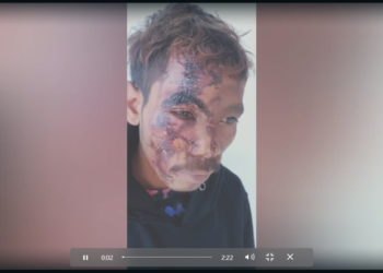 konfrontu iha Hato-builico rezulta na’in ida kanek todan no ida seluk matan bubu