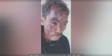 konfrontu iha Hato-builico rezulta na’in ida kanek todan no ida seluk matan bubu