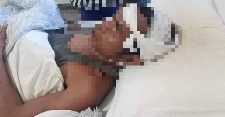 TDS Suai Aplika Medida Koasaun Prizaun Preventiva ba Suspeitu ADKazu Mau-Ulo