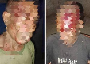 Konfrontu Iha Leotelo Mauchiga Ainaro Kauza Husi Sunu Fugete Iha Prezepiu