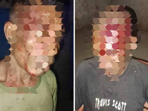 Konfrontu Iha Leotelo Mauchiga Ainaro Kauza Husi Sunu Fugete Iha Prezepiu